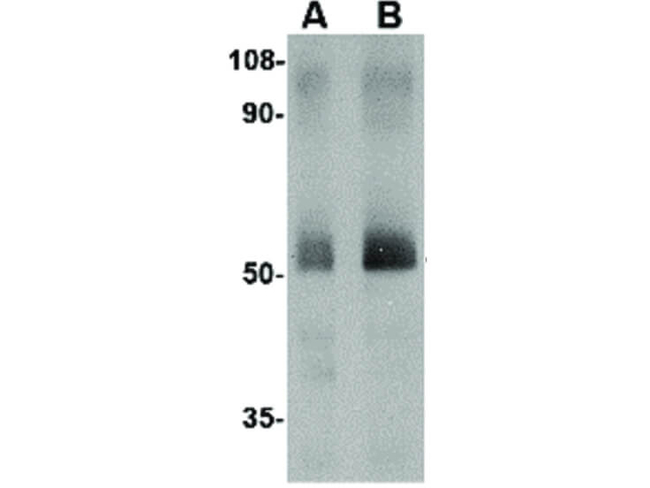 Spred2 Antibody in Western Blot (WB)