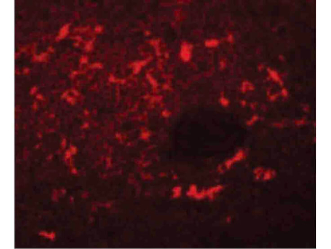 SQSTM1 Antibody in Immunocytochemistry (ICC/IF)