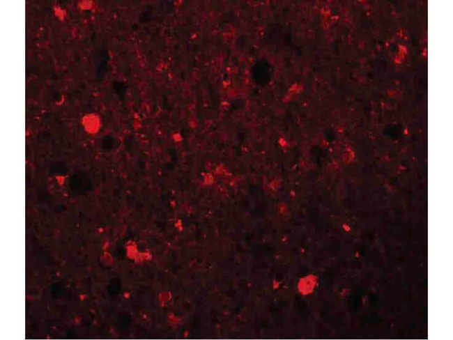 SRPX1 Antibody in Immunocytochemistry (ICC/IF)
