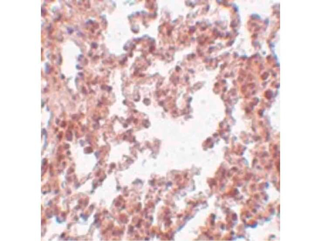 SRPX2 Antibody in Immunohistochemistry (Paraffin) (IHC (P))