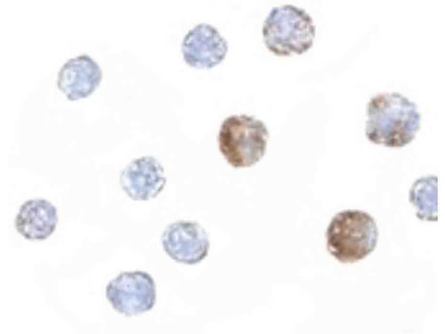 ST3gal6 Antibody in Immunocytochemistry (ICC/IF)