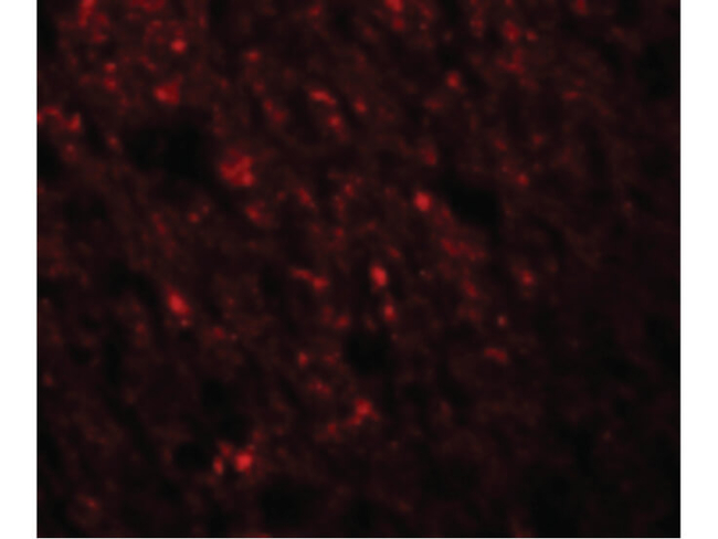 STAU1 Antibody in Immunocytochemistry (ICC/IF)