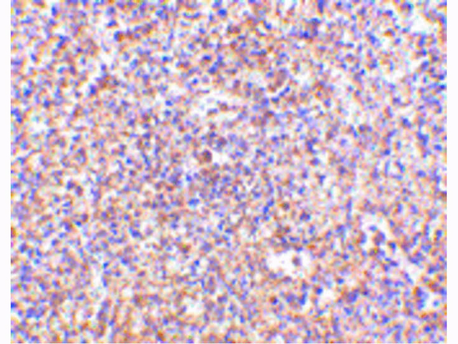 STEAP1 Antibody in Immunohistochemistry (Paraffin) (IHC (P))