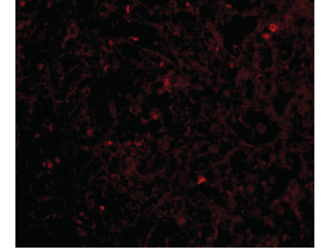 STEAP1 Antibody in Immunocytochemistry (ICC/IF)