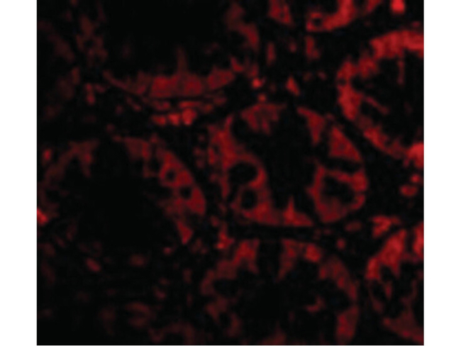 STEAP2 Antibody in Immunocytochemistry (ICC/IF)