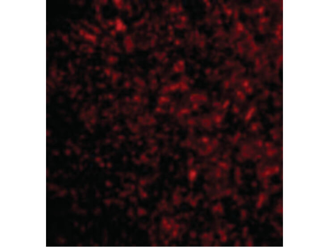 STEAP3 Antibody in Immunocytochemistry (ICC/IF)