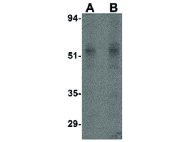 STEAP4 Antibody in Western Blot (WB)