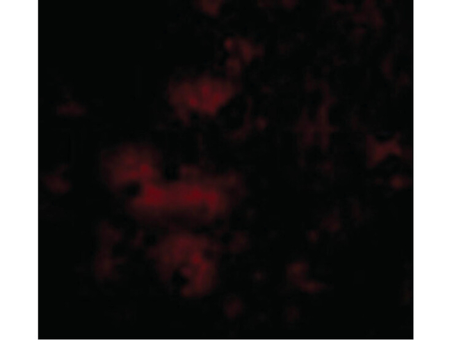 STIM2 Antibody in Immunocytochemistry (ICC/IF)