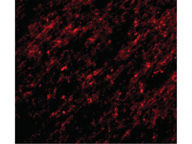 Stk39 Antibody in Immunocytochemistry (ICC/IF)