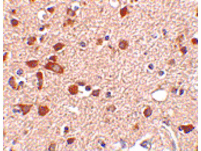 Stk39 Antibody in Immunohistochemistry (Paraffin) (IHC (P))