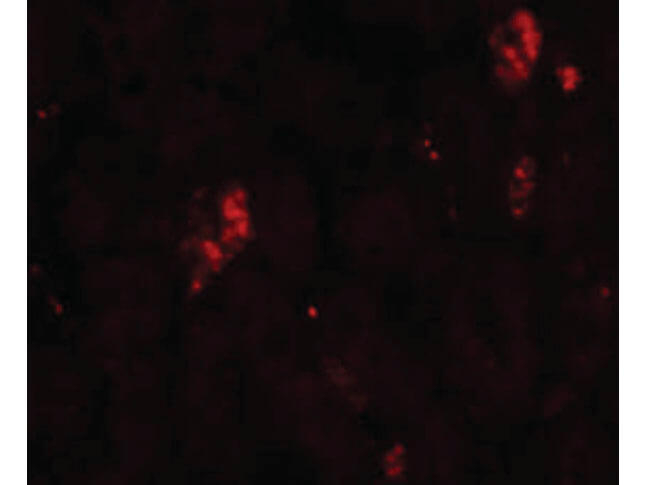 SUMO2/3 Antibody in Immunocytochemistry (ICC/IF)