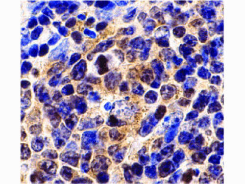 Survivin Antibody in Immunohistochemistry (Paraffin) (IHC (P))