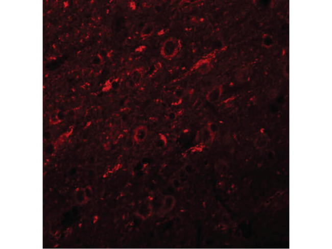 SYNGR2 Antibody in Immunocytochemistry (ICC/IF)
