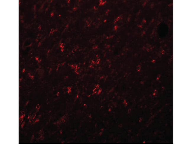 SYNGR4 Antibody in Immunocytochemistry (ICC/IF)