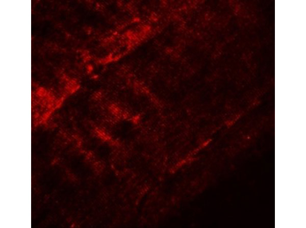 SYNPO2 Antibody in Immunocytochemistry (ICC/IF)