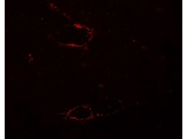 SYNPO2L Antibody in Immunocytochemistry (ICC/IF)