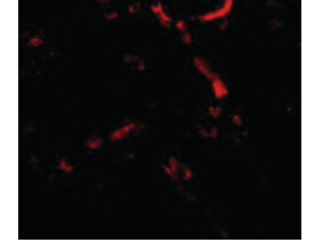Syntaphilin Antibody in Immunocytochemistry (ICC/IF)