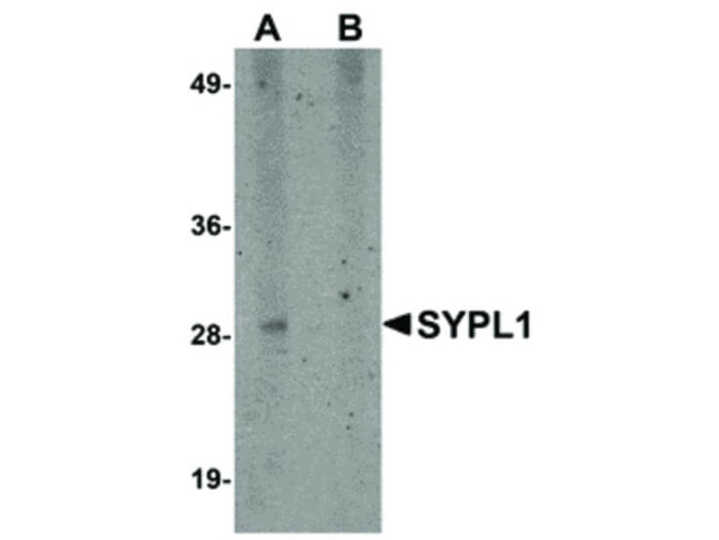 SYPL1 Antibody in Western Blot (WB)