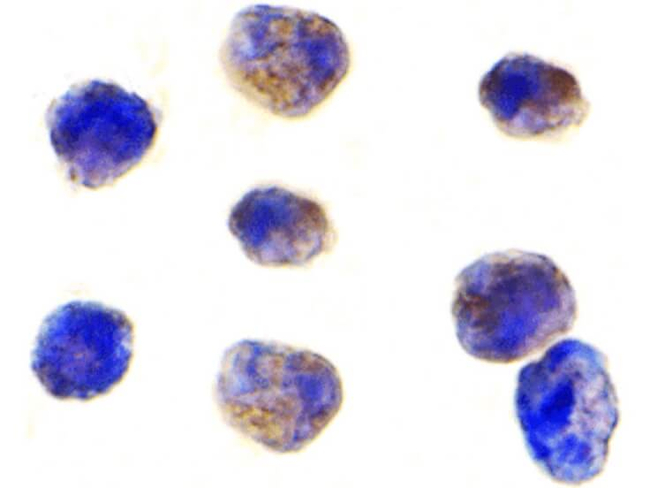 TAB1 Antibody in Immunocytochemistry (ICC/IF)