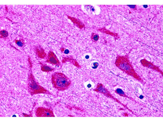 TAB2 Antibody in Immunohistochemistry (Paraffin) (IHC (P))