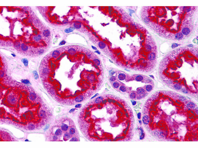 TAB3 Antibody in Immunohistochemistry (Paraffin) (IHC (P))