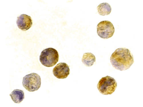 TACI Antibody in Immunocytochemistry (ICC/IF)