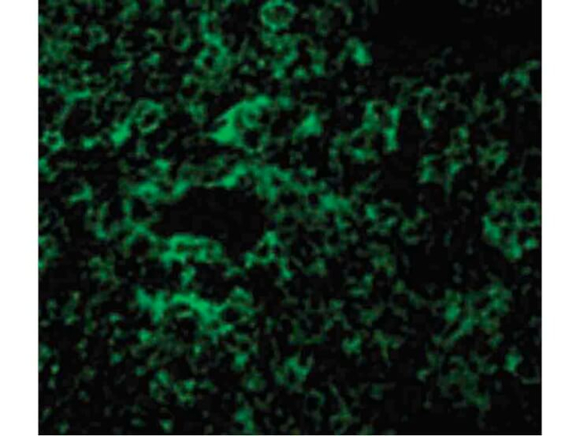 TAK1 Antibody in Immunocytochemistry (ICC/IF)