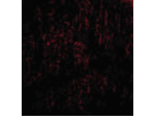 TANK Antibody in Immunocytochemistry (ICC/IF)