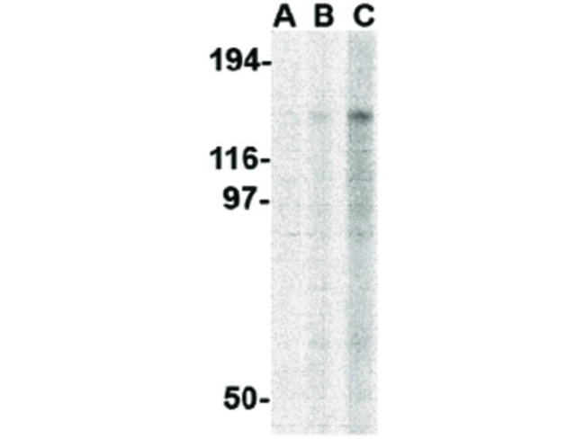 TBC1D1 Antibody in Western Blot (WB)