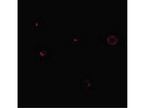 TCCR Antibody in Immunocytochemistry (ICC/IF)