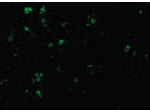 TCCR Antibody in Immunocytochemistry (ICC/IF)