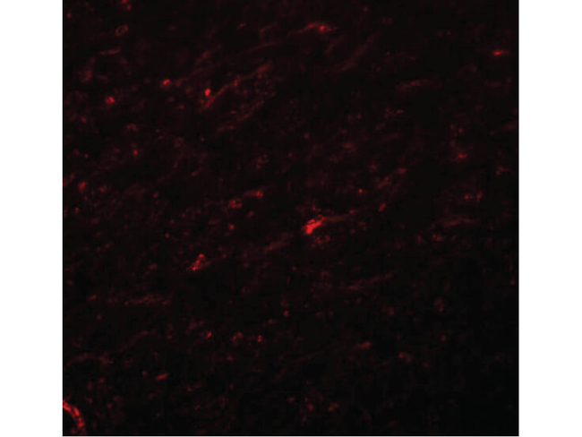 TCF3 Antibody in Immunocytochemistry (ICC/IF)