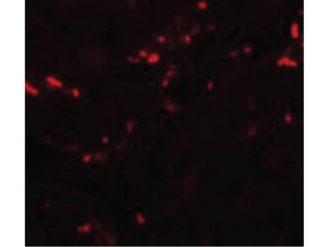 TCTN1 Antibody in Immunocytochemistry (ICC/IF)