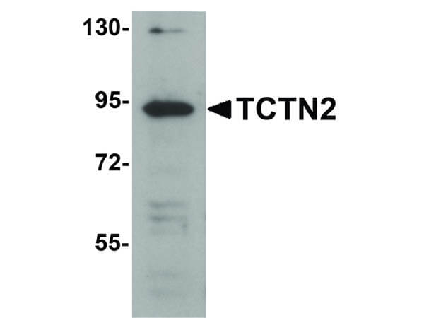 TCTN2 Antibody in Western Blot (WB)