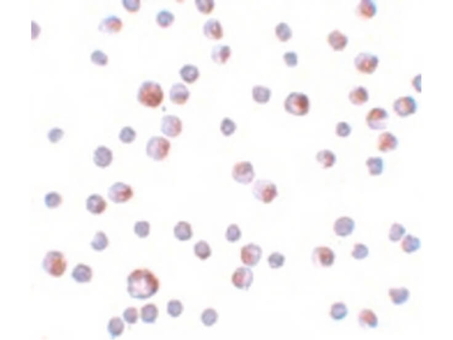 TCTN3 Antibody in Immunocytochemistry (ICC/IF)