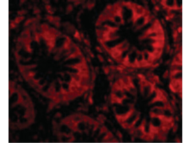 TEM1 Antibody in Immunocytochemistry (ICC/IF)