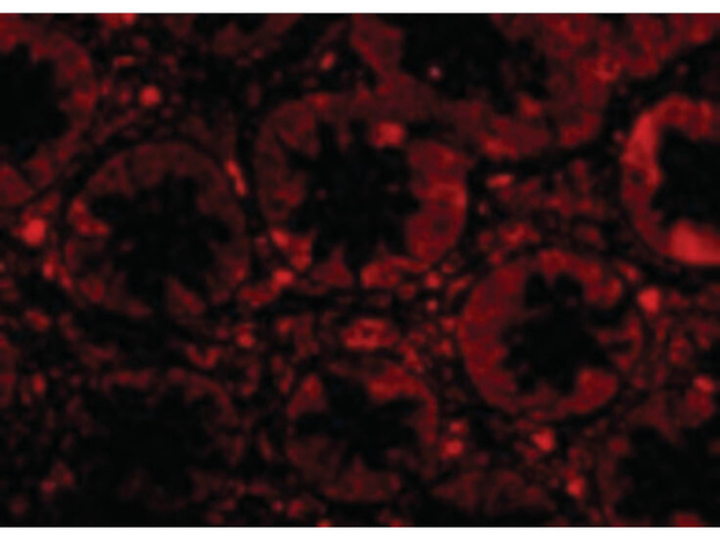 TEM1 Antibody in Immunocytochemistry (ICC/IF)