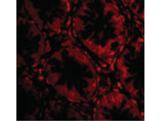 TEM2 Antibody in Immunocytochemistry (ICC/IF)