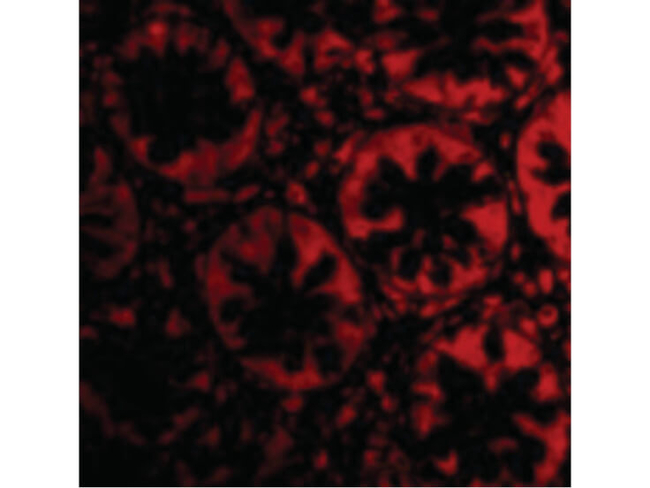 TEM2 Antibody in Immunocytochemistry (ICC/IF)