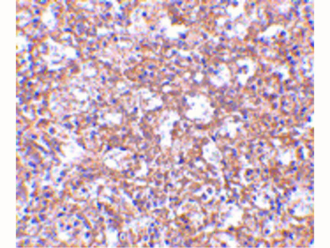 TEM4 Antibody in Immunohistochemistry (Paraffin) (IHC (P))
