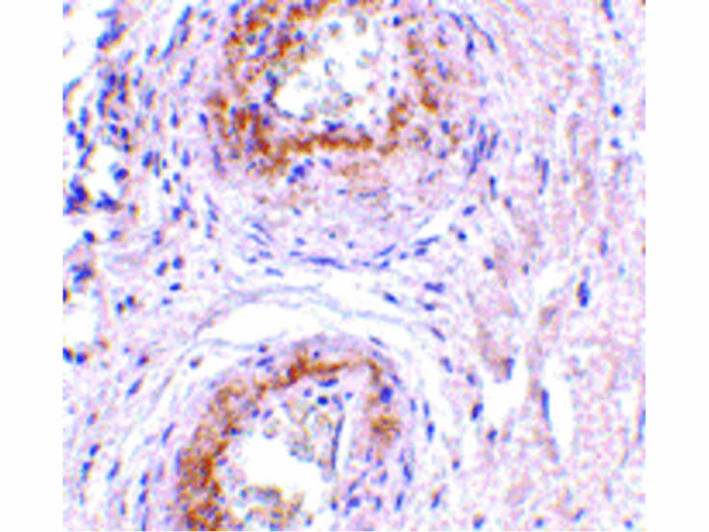 TEM5 Antibody in Immunohistochemistry (Paraffin) (IHC (P))