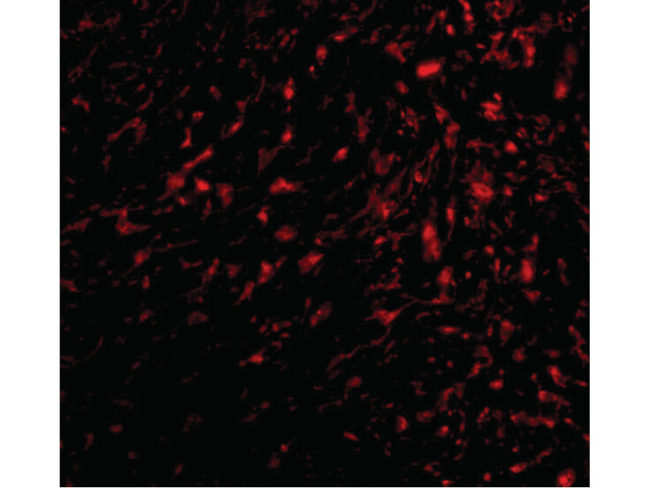 TEM5 Antibody in Immunocytochemistry (ICC/IF)