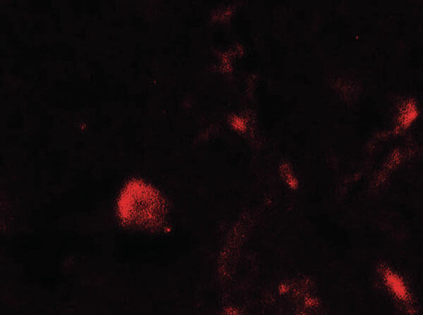 TET1 Antibody in Immunocytochemistry (ICC/IF)