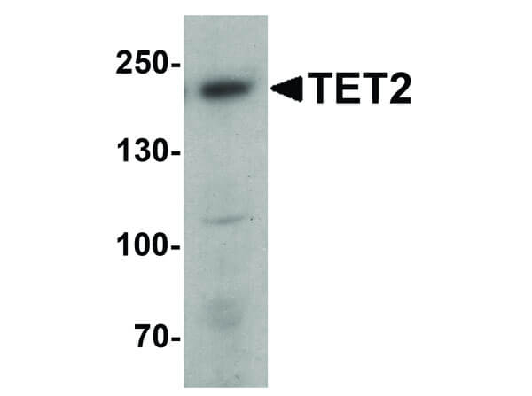 TET2 Antibody in Western Blot (WB)
