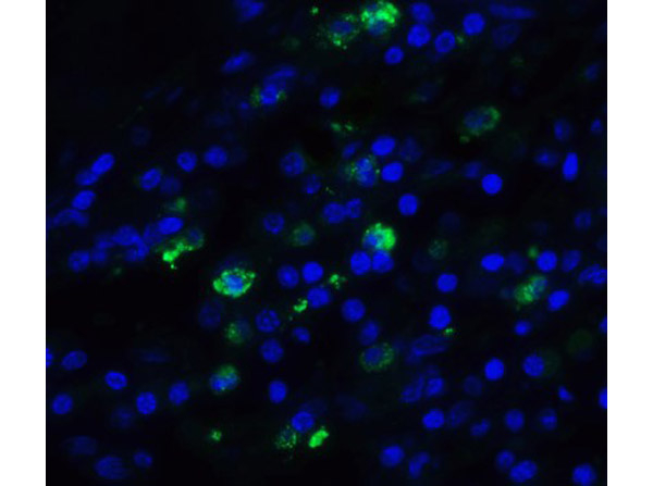 TFF3 Antibody in Immunocytochemistry (ICC/IF)