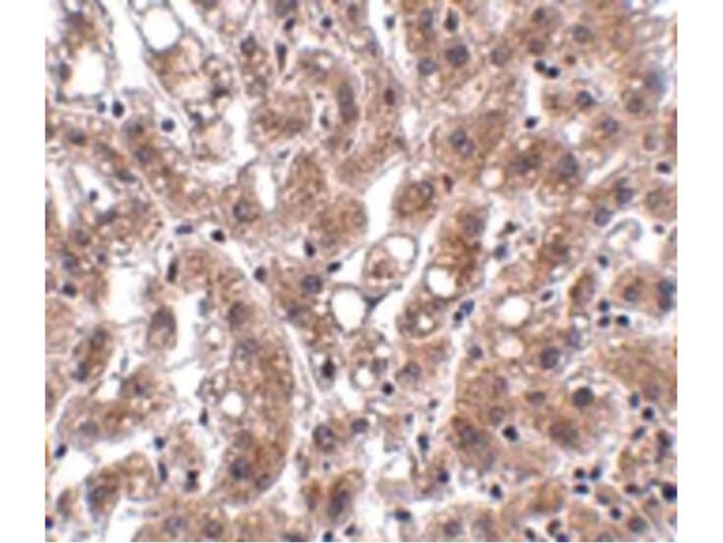 THEM4 Antibody in Immunohistochemistry (Paraffin) (IHC (P))