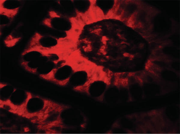 TICRR Antibody in Immunocytochemistry (ICC/IF)