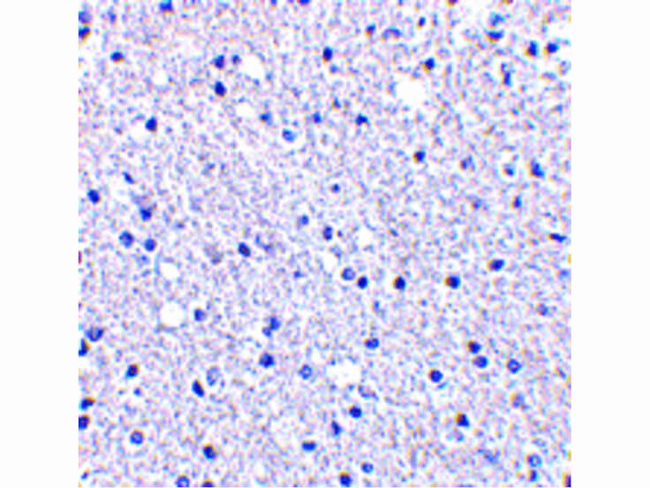 TIGAR Antibody in Immunohistochemistry (Paraffin) (IHC (P))