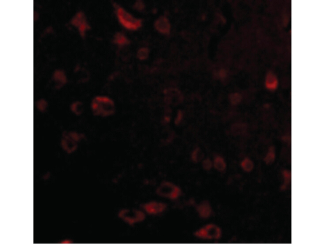 TIGAR Antibody in Immunocytochemistry (ICC/IF)
