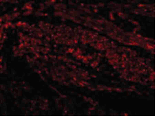 TIM-1 Antibody in Immunocytochemistry (ICC/IF)